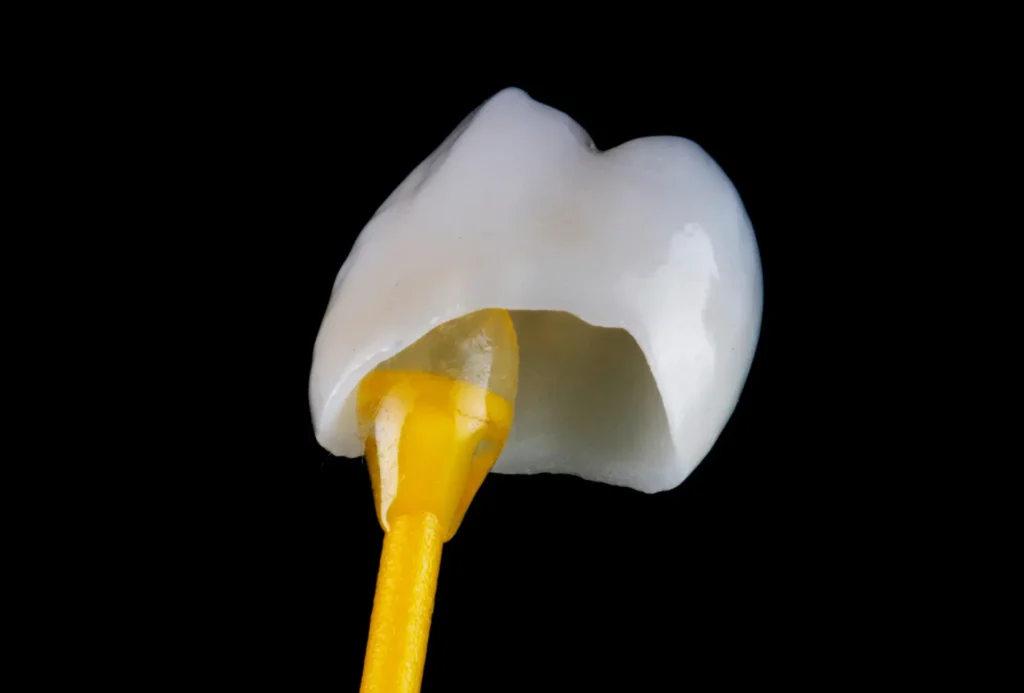 Dental Crowns in Flower Mound, TX