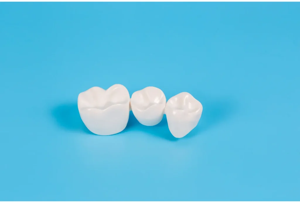 What is a Dental Crown