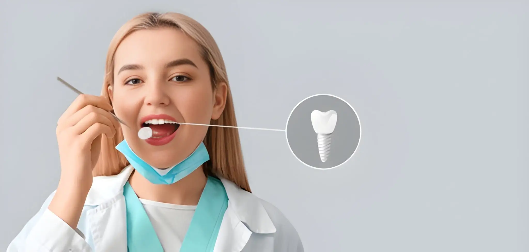 Dental implants restoration Flower Mound TX model showing titanium post and crown at Supreme Smiles Dentistry