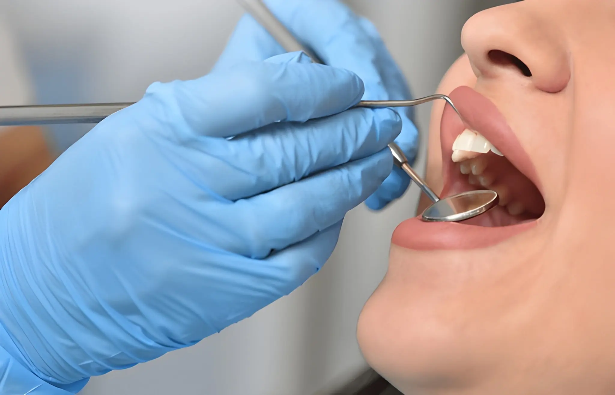 Periodontal treatment in Flower Mound TX dentist performing gum examination at Supreme Smiles Dentistry.
