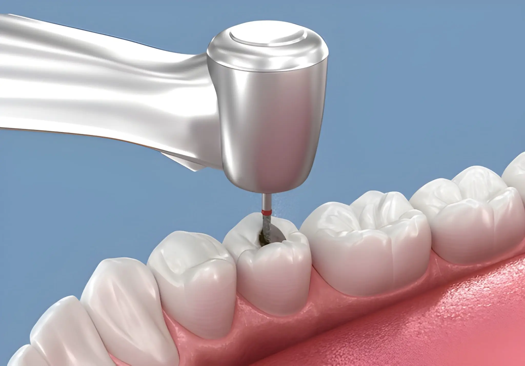 Root canal treatment Flower Mound TX 3D diagram showing rotary file cleaning tooth canals