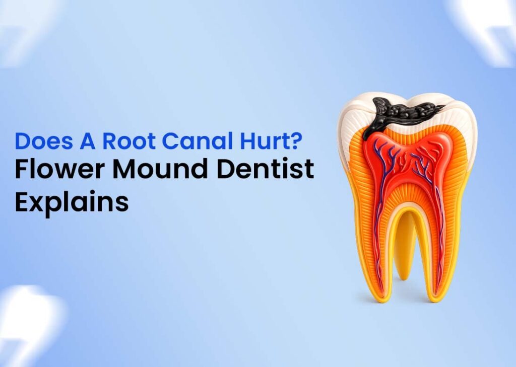 Does a Root Canal Hurt Flower Mound Dentist Explains