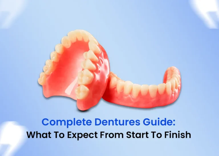 Complete Dentures Guide What to Expect from Start to Finish